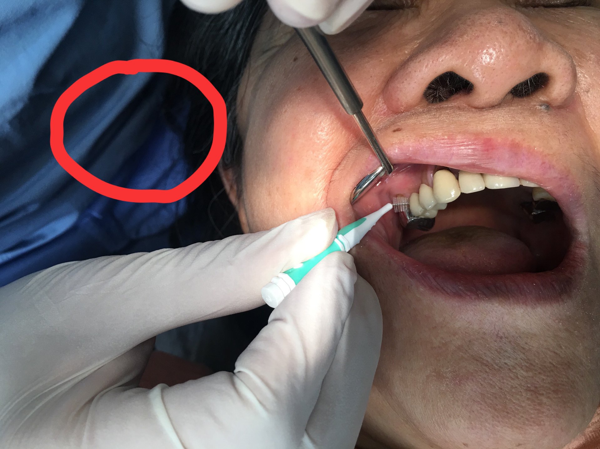 差之毫釐,繆以千里——-臨床有感 差之毫釐,繆以千里——-臨床有感