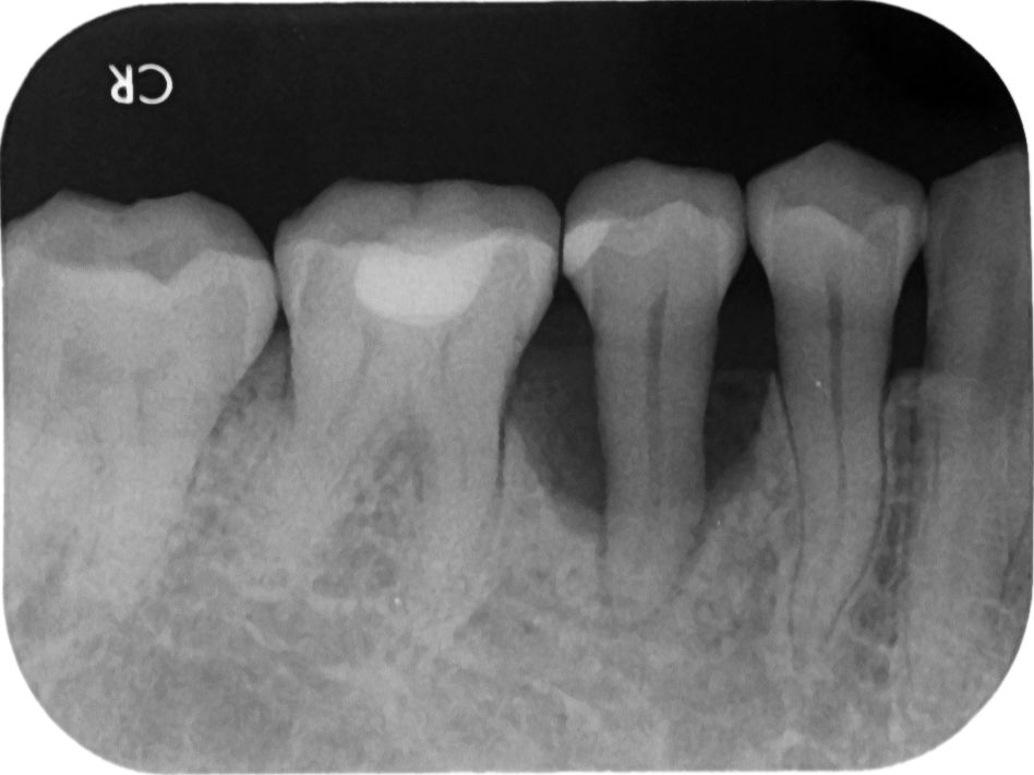 <從一顆病牙談起> <從一顆病牙談起>