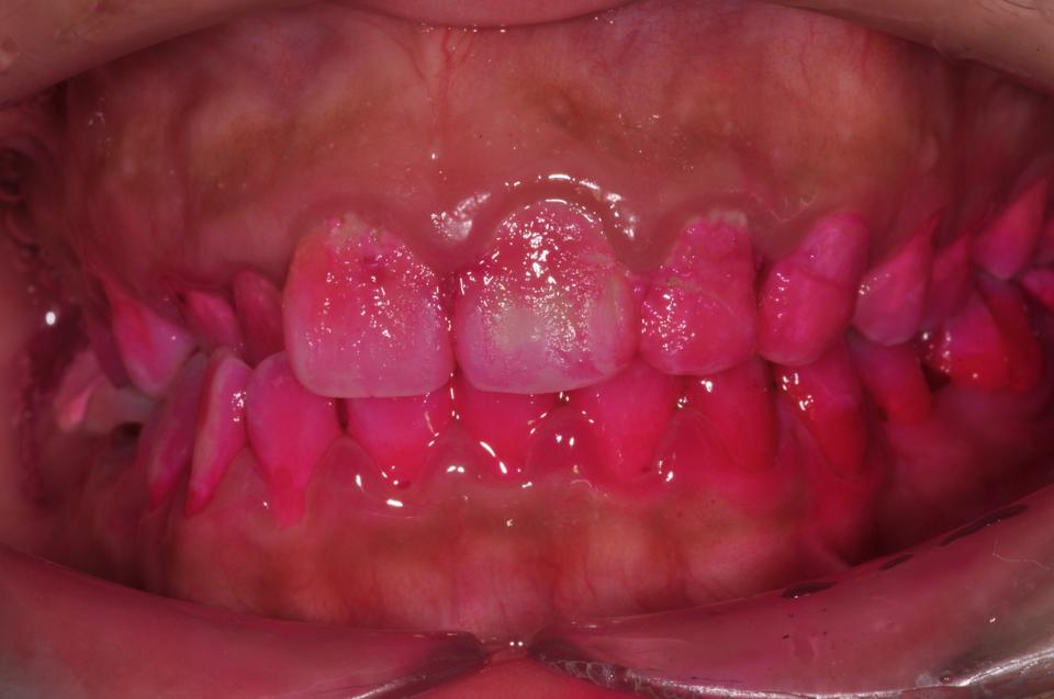 永恆的追求(二) 永恆的追求(二)