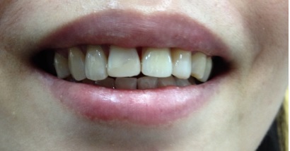 這種情況接下來該怎麼辦咧??? 這種情況接下來該怎麼辦咧???